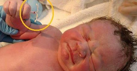 Zeznuo ih sve: Rodio se držeći maminu spiralu protiv začeća