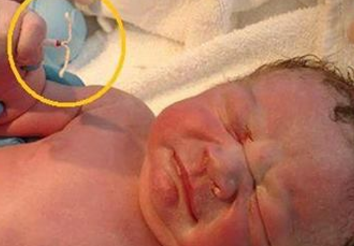 Zeznuo ih sve: Rodio se držeći maminu spiralu protiv začeća