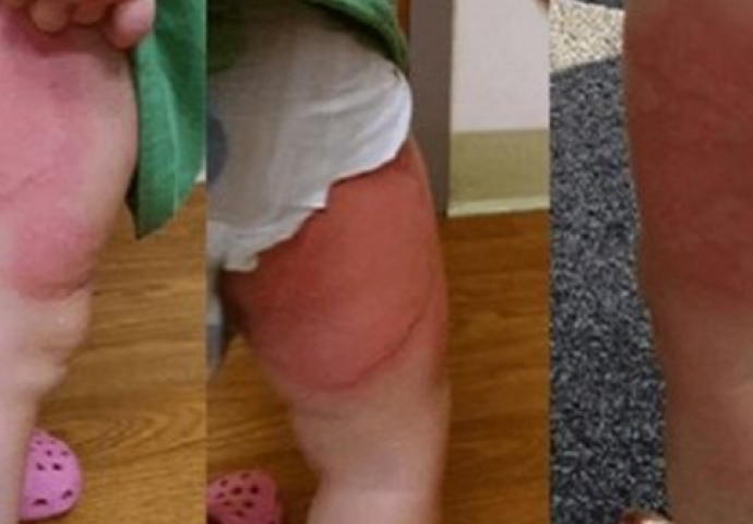 UPOZORENJE RODITELJIMA: Žitarice koje morate odmah  IZBACITE iz vašeg DOMA! Evo šta se desilo njenom djetetu…