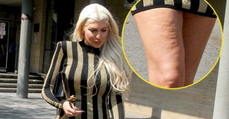 CELULIT NA SVE STRANE: Ovako Karleuša izgleda bez photoshopa!