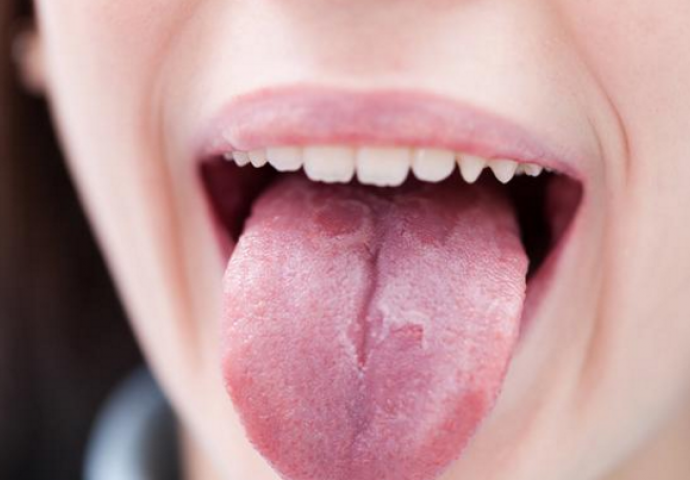 Ako je vaš jezik ovakav - posjetite doktora