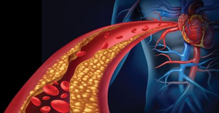 DOKTORI VAM OVO NEĆE REĆI: Najbolji lijek iz prirode protiv holesterola i visokog krvnog pritiska!
