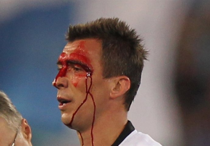 Mandžukić sav krvav: Navijači Juventusa su prvo zanijemili, a sada mu se dive