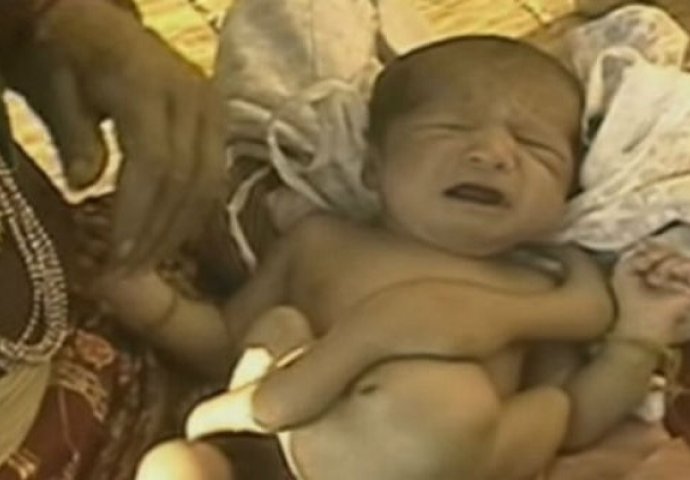 Ova beba je rođena sa 8 udova i smatrali su je božanstvom, a onda su shvatili šta se zapravo dogodilo! (VIDEO)