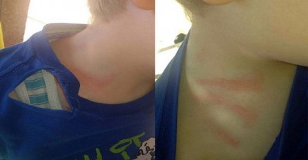 Majka petogodišnjaka optužuje: Vaspitačica mi tukla dijete!