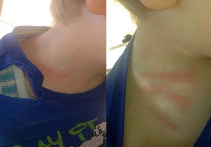 Majka petogodišnjaka optužuje: Vaspitačica mi tukla dijete!