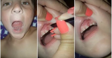 Odvratan video pokazuje na šta liče usta djeteta koje grize nokte