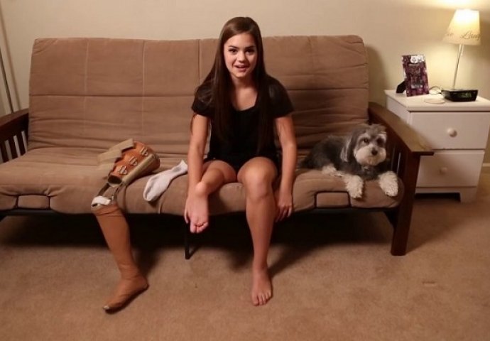 Doktori su joj amputirali nogu a zatim je naopako zašili, razlog će vas ostaviti bez teksta! (VIDEO)