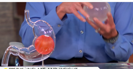 SENZACIJA U BORBI PROTIV GOJAZNOSTI: Gutanjem balona gube višak kilograma! (VIDEO)