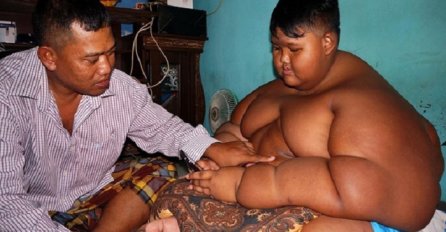 Ima 10 godina i skoro 200 kilograma: Smanjili su mu želudac a on je i dalje gladan (VIDEO)