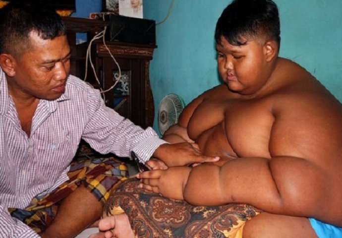 Ima 10 godina i skoro 200 kilograma: Smanjili su mu želudac a on je i dalje gladan (VIDEO)
