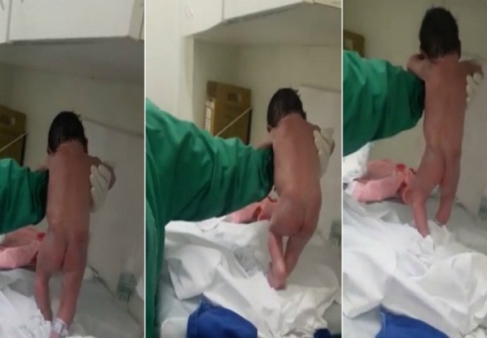   Novorođenče se umjesto prvog kupanja, odlučilo prošetati po rađaonici