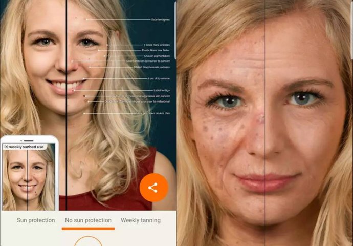 Aplikacija koja prepoznaje rak kože