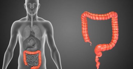 Ako sumnjate na upalu slijepog crijeva pod hitno idite liječniku!