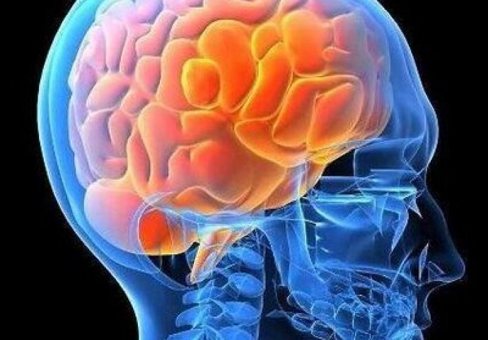 MOĆ ozbiljno šteti mozgu i može doći do trajnog funkcionalnog oštećenja!
