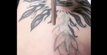 Mislili ste da su tetovaže trajne - VARATE SE: Ovim laserom tetovaža se skida za nekoliko sekundi (VIDEO)