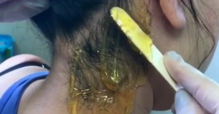 Depilacija kose: Jesmo li toliko zaslijepljeni modnim trendovima?  