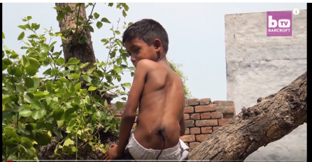 CIJELO SELO SE KLANJA OVOM DJEČAKU: Smatraju ga božanstvom koje je rođeno sa REPOM na leđima (VIDEO)