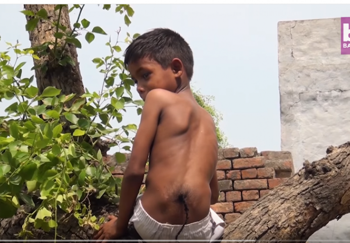 CIJELO SELO SE KLANJA OVOM DJEČAKU: Smatraju ga božanstvom koje je rođeno sa REPOM na leđima (VIDEO)