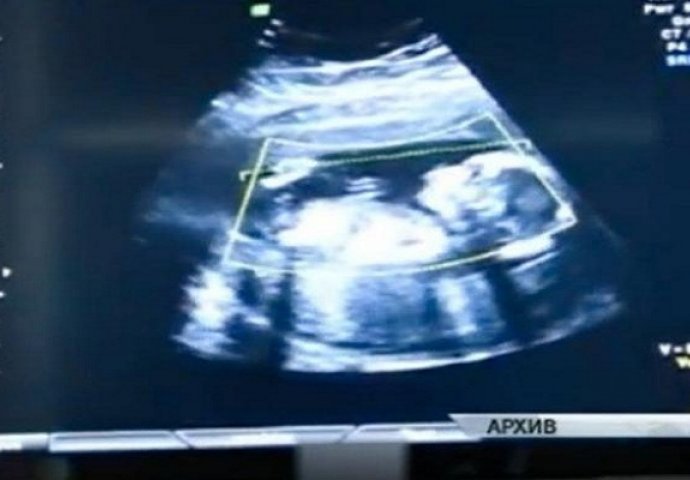 Trudnica nije išla na pregled 41 nedjelju, cijela bolnica bila je šokirana kad je krenuo porod!(VIDEO)