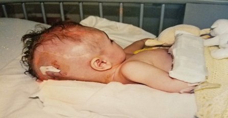 Kada mi se sin rodio, ljekari su htjeli da ga uspavaju: Danas ima 13 godina i lice mu je duplirano