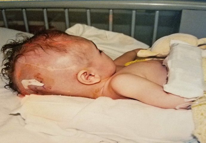 Kada mi se sin rodio, ljekari su htjeli da ga uspavaju: Danas ima 13 godina i lice mu je duplirano