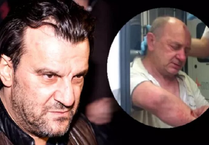 SKANDAL! Aca Lukas brutalno pretukao fotografa "Srpskog Telegrafa", prijetio mu i završio u policiji!