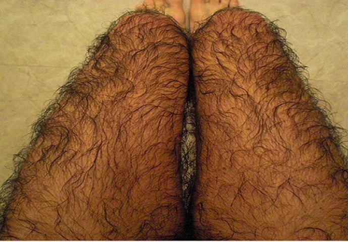 Fotografija ŠOKIRALA sve: Da li su ovo muške ili ženske noge?