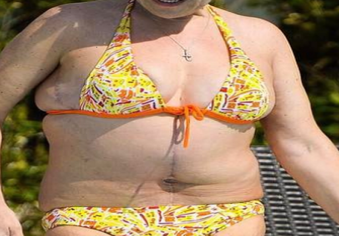 Glumica je pred ljeto skinula 76 kilograma: Sada plažom ponosno šeta ovakvo tijelo
