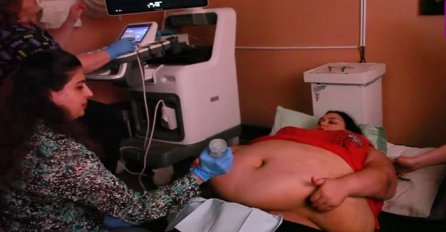 Trudna žena ima 226 kilograma i došla je na ultrazvuk, a onda je medicinska sestra podigla njen stomak i pogledala bolje (VIDEO)