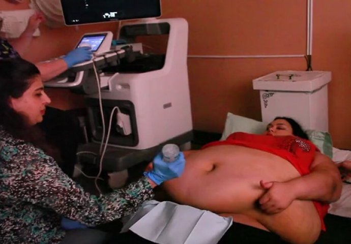 Trudna žena ima 226 kilograma i došla je na ultrazvuk, a onda je medicinska sestra podigla njen stomak i pogledala bolje (VIDEO)