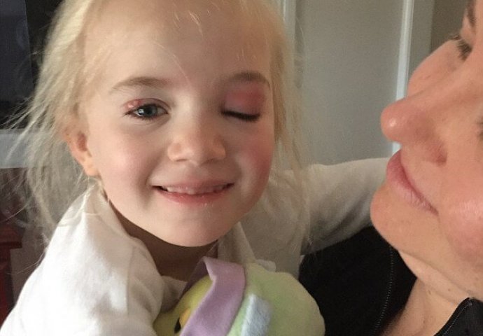 Doktori su bili ubjeđeni da djevojčica ima infekciju oka, ali njena mama je znala da je u pitanju nešto veoma strašno (FOTO, VIDEO)