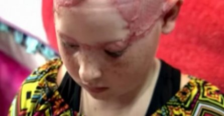 Kosa 11-godišnje djevojčice je zapela na vožnji u zabavnom parku, skalpirana je pred očima svoje majke! (VIDEO)