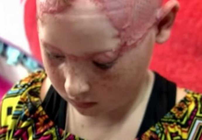 Kosa 11-godišnje djevojčice je zapela na vožnji u zabavnom parku, skalpirana je pred očima svoje majke! (VIDEO)