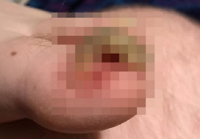 Upoznao je savršenu djevojku, a kada je skinula čarape - ZGADIO MU SE ŽIVOT (FOTO)