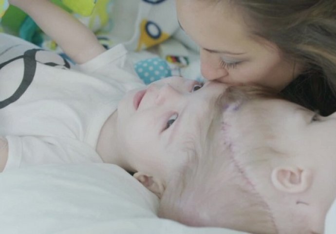 Majka posljednji put ljubi svoje sijamske blizance, nekoliko trenutaka kasnije se događa čudo! (VIDEO)