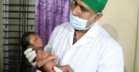 Kada je ova beba rođena, ljekari su majci rekli da nikada nisu vidjeli lice poput njenog! (VIDEO)