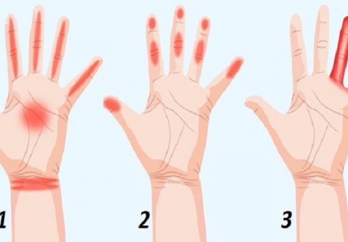 Deset najvažnijih stvari koje ruke otkrivaju o vašem zdravlju