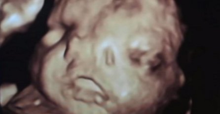 Kada su ljekari vidjeli na ultrazvuku nešto što nisu nikada do sada, budućoj majci su rekli loše vijesti! (VIDEO)