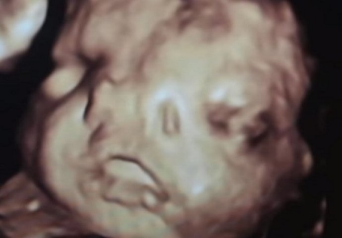 Kada su ljekari vidjeli na ultrazvuku nešto što nisu nikada do sada, budućoj majci su rekli loše vijesti! (VIDEO)