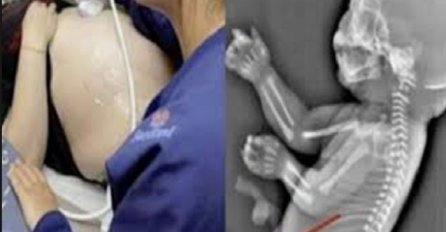 Beba abortirana nakon što je na ultrazvuku snimljeno nešto strašno (VIDEO)
