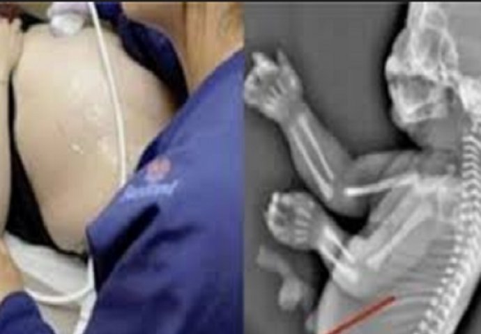 Beba abortirana nakon što je na ultrazvuku snimljeno nešto strašno (VIDEO)