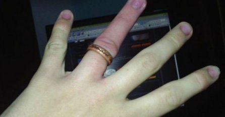 ČAK NI U BOLNICI JOJ NIJE BILO POMOĆI: Prsten joj zaglavio na prstu, a skinula ga je na nevjerovatan način! (VIDEO)