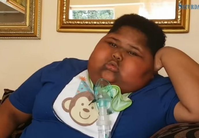 PRIJETI MU SMRT: Desetogodišnjak je stalno gladan, ima preko 90 kg, jede čak i toaletni papir (VIDEO)