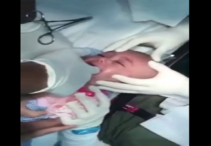 Odvela je svoju bebu u hitnu jer nije mogla disati: Kada je vidjela šta su doktoru izvukli iz njenog grla, ostala je bez riječi! (VIDEO)