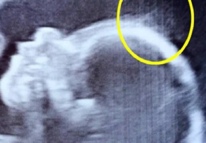 Beba je rođena sa neviđenom kosom: Nakon par nedjelja, majka je objavila slike koje su obišle svijet! (VIDEO)