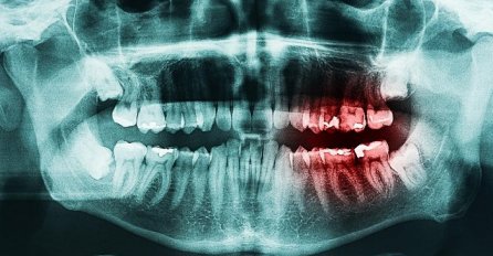 Deset stvari koje se ljudima mogu dogoditi ako ne vole prati zube 