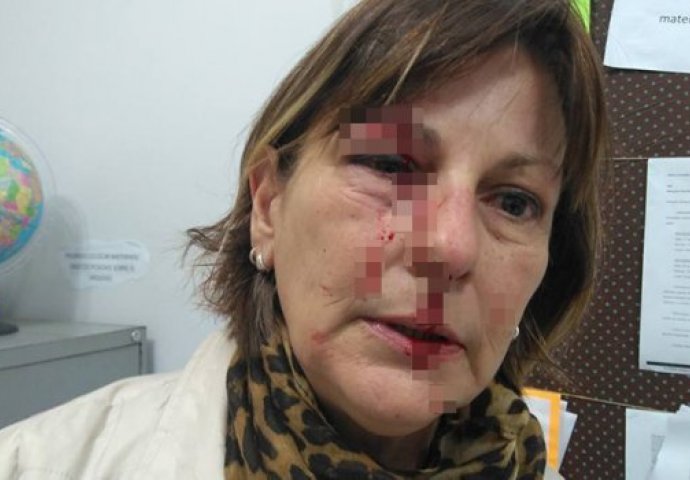 UČENIK TOKOM ČASA BRUTALNO NAPAO PROFESORICU: Posljednji udarac je bacio na zid, cijela učionica je bila krvava (FOTO)