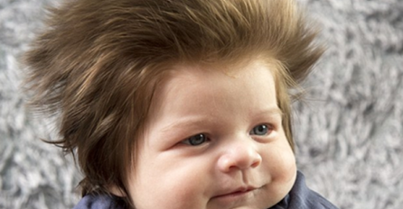 ISTINA ILI MIT: Jesu li žgaravica i količina bebine kose povezani?