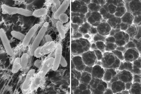 quibbll-com-yaponskie-uchenye-otkryli-novyj-vid-bakterij-pitayushhihsya-plastikom-3